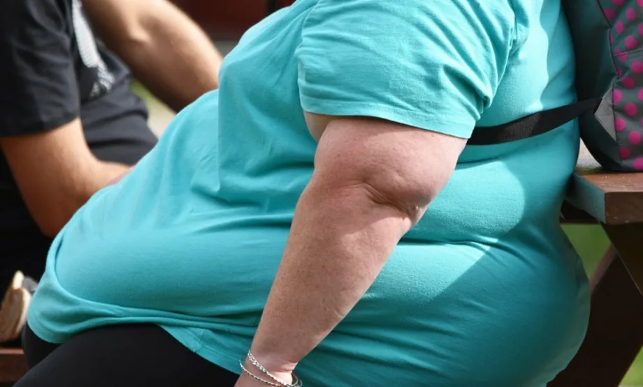 Obesidad en Estados Unidos: el desafío de la prevención